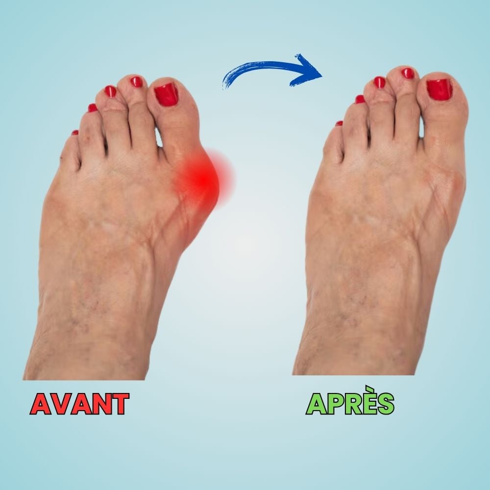 Semelles PodoFlex™ - Une journée entière sans douleur